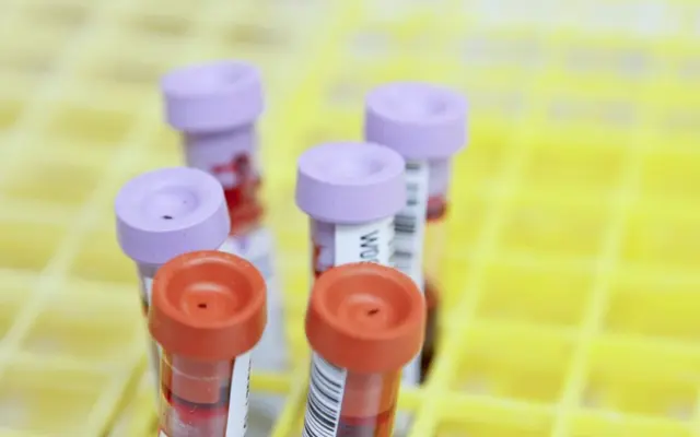 Provette di laboratorio per analisi cliniche